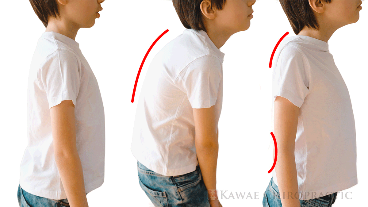 こどもの姿勢を改善