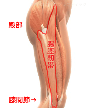 ランナー膝・腸脛靭帯の位置